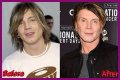 John Rzeznik Facelift | Goo Goo Dolls Frontman Plastic Surgery Before And After